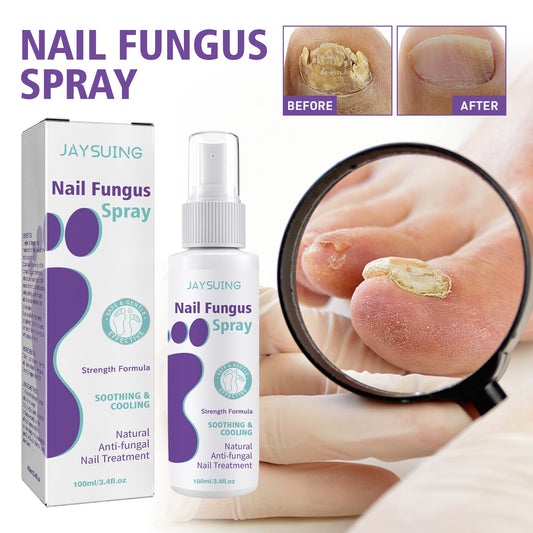 Nail Repair & Care Spray – 100ml MERLIÁ