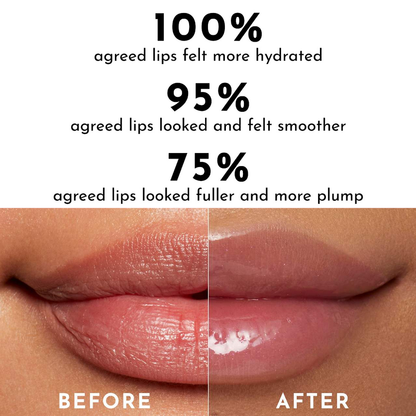 PHOFAY Hyaluronic Lip Gloss MERLIÁ